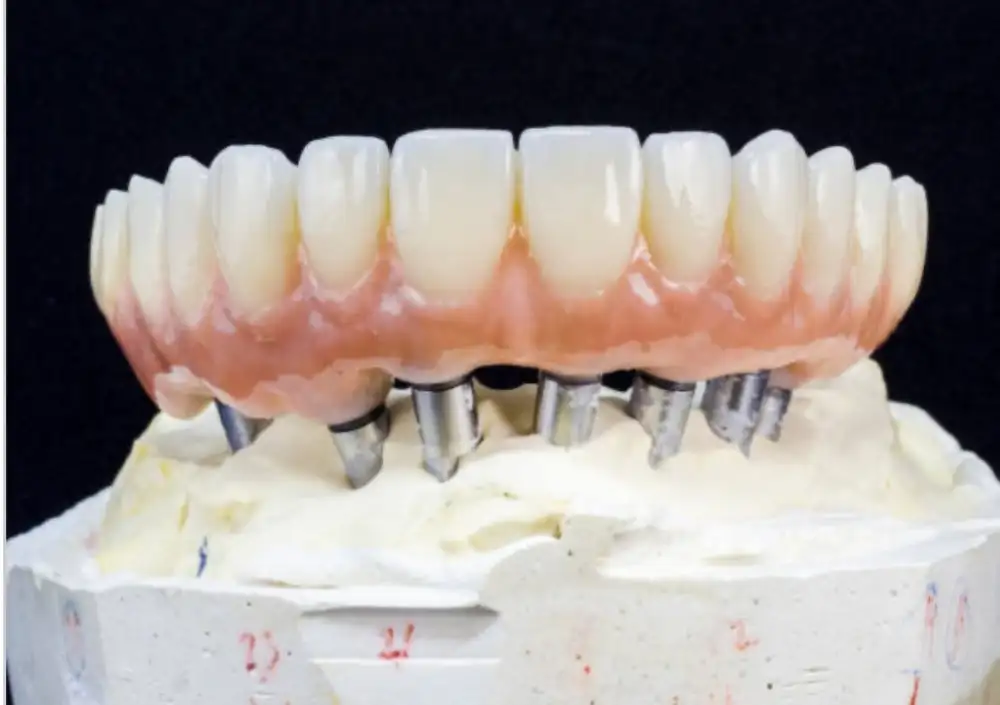 Denture New